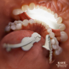 Album artwork for Escapism. / The Thrill Is Gone. by RAYE